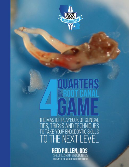 The 4 Quarters of the Root Canal Game Playbook Root Canal Academy