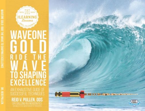 Wave One Rct WaveOne Gold: Ride the Wave to Shaping Excellence DIGITAL - Root Canal ...